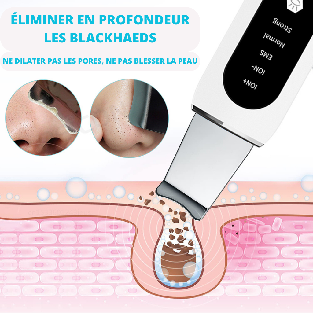 EPURATEUR DE VISAGE A ULTRASONS <br> Modèle # SUMMER