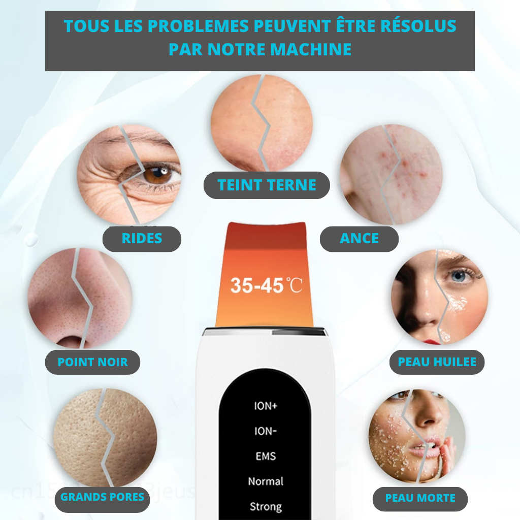 EPURATEUR DE VISAGE A ULTRASONS <br> Modèle # SUMMER